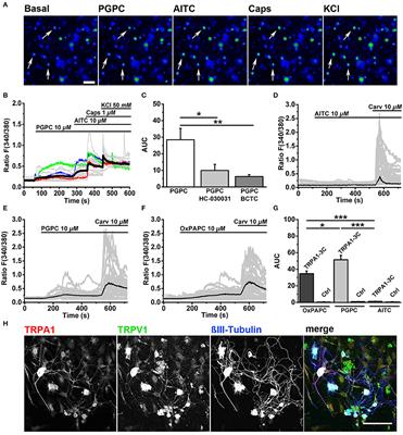 NaV1.9 Potentiates Oxidized Phospholipid-Induced TRP Responses Only under Inflammatory Conditions